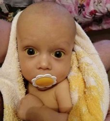 Шестимесячному мальчику из Омска требуется пересадка печени Шестимесячному мальчику из Омска требуется пересадка печени
