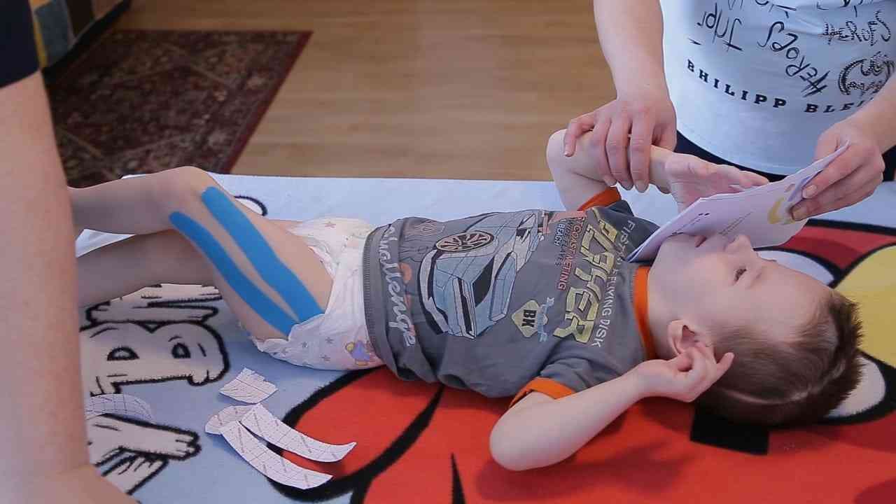 Операции при дцп. Спастика мышц ног у ребенка. Спастика при ДЦП У детей.